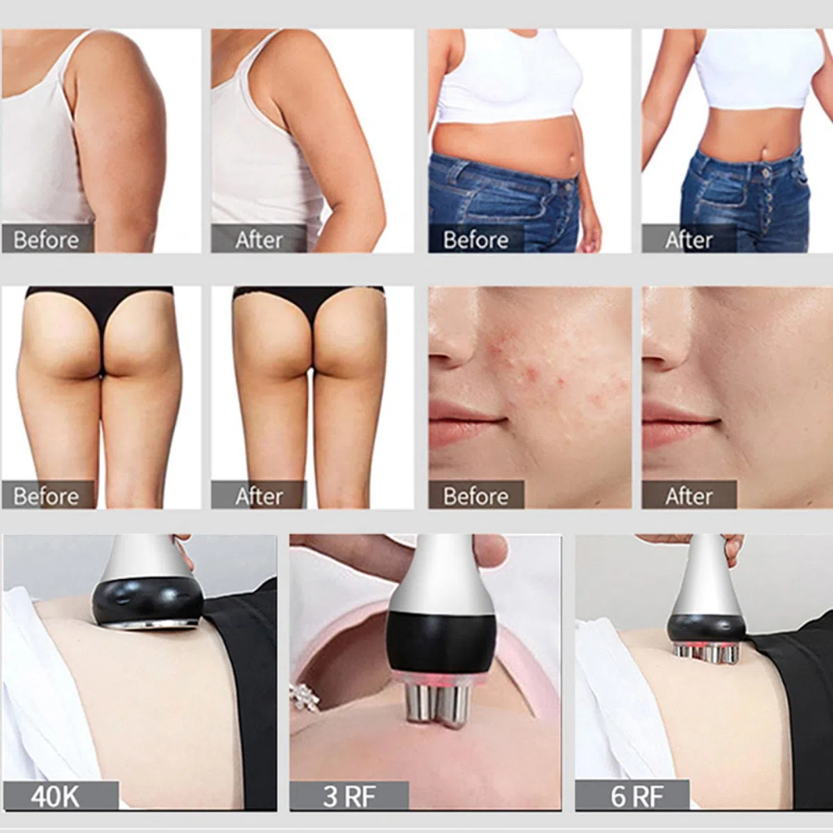 Instrument de beauté 40k Cavitation Corps Minceur Machine Masseur Facial RF Appareil de Beauté Peau Serrer Visage Lifting Outil de Soins de La Peau poignée en métal