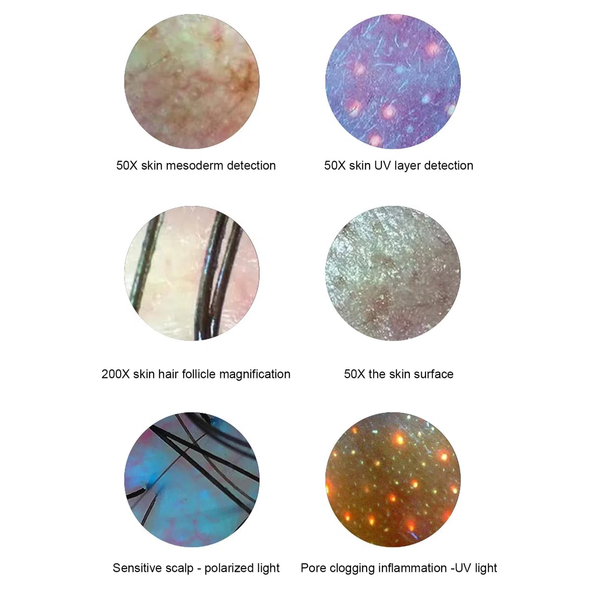 Analyseur de Cheveux de Diagnostic de Peau, 15,6 Pouces 50X 200X Détecteur de Cuir chevelu de Cheveux de Peau Microscope de Cuir chevelu Analyseur de Cuir chevelu de Peau de follicule pileux(EU)