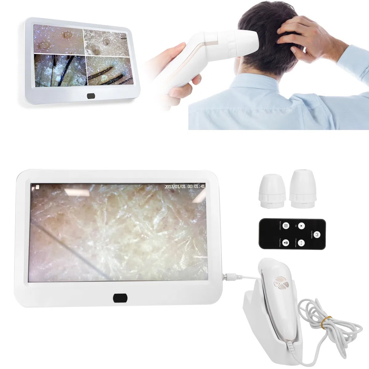 Analyseur de Cheveux de Diagnostic de Peau, 15,6 Pouces 50X 200X Détecteur de Cuir chevelu de Cheveux de Peau Microscope de Cuir chevelu Analyseur de Cuir chevelu de Peau de follicule pileux(EU)